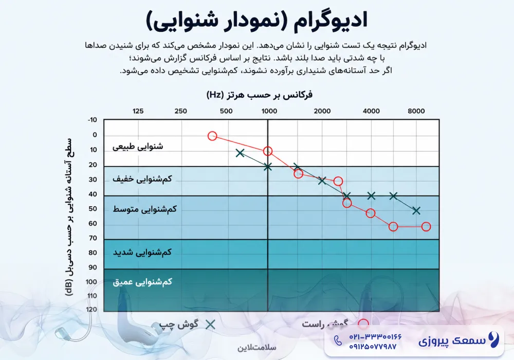 بهترین سمعک برای کم شنوایی حسی عصبی